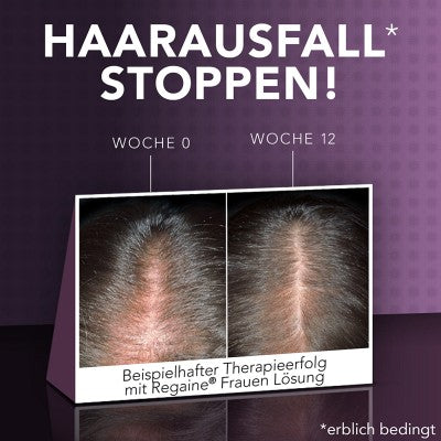 REGAINE® Women's Solution with Minoxidil - 3x60ml