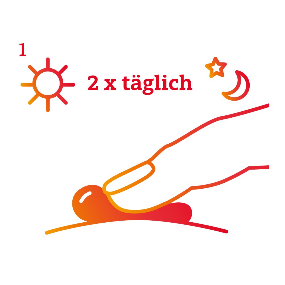 DICLO Schmerzgel forte - Zur kurzzeitigen lokalen, symptomatischen Behandlung von leichten bis mäßig starken Schmerzen bei akuten Zerrungen, Verstauchungen oder Prellungen