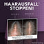 REGAINE® Frauen Lösung mit Minoxidil - 3x60ml