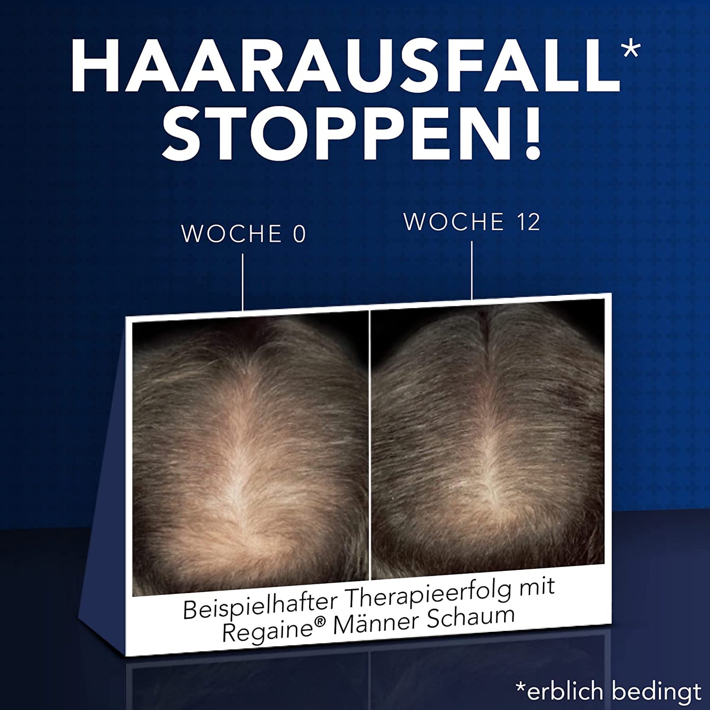 REGAINE Männer Schaum: 3-Monatspackung mit 50 mg/g Minoxidil 3 x 60 g